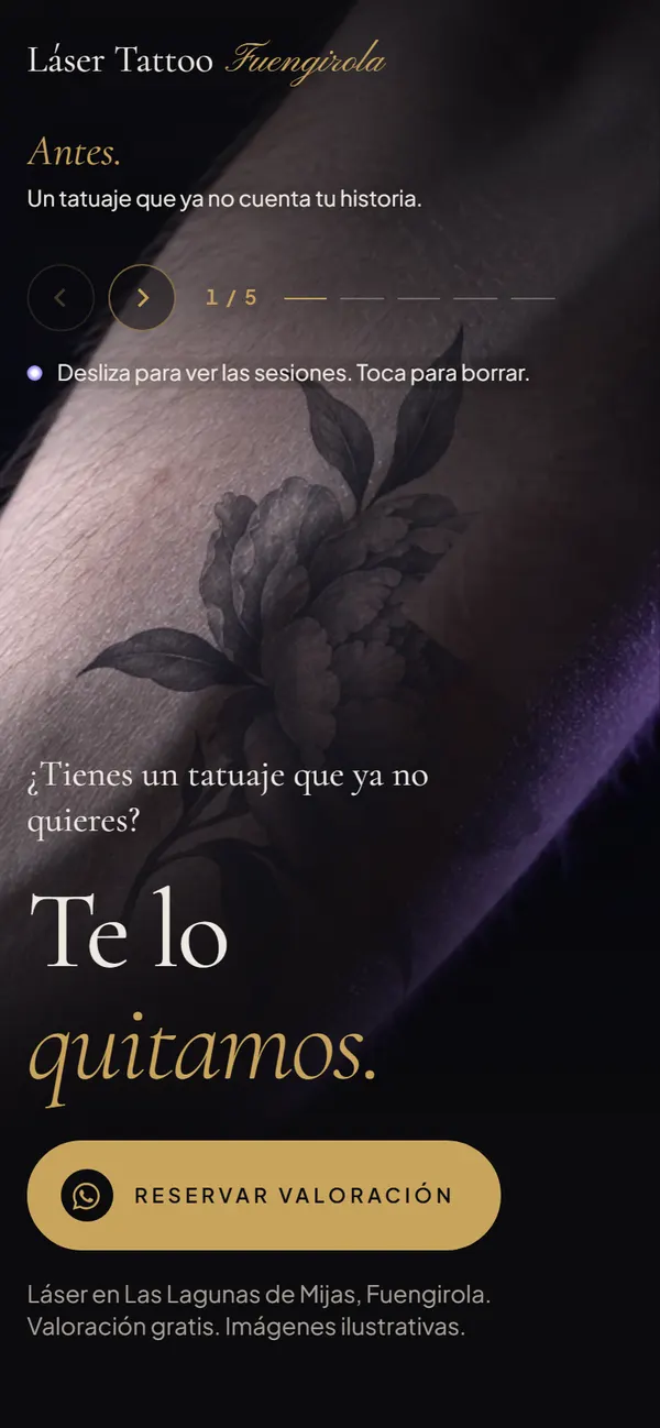 Láser Tattoo Fuengirola en el móvil